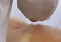 王瑞雪针灸私密女士篇,揭秘女性健康养生之道